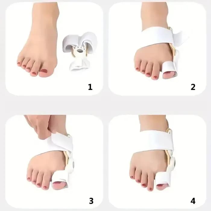 Orthèse pour Hallux Valgus (Oignon) – Modèle Jour et Nuit – Chaussures pour Hommes et Femmes avec Doigts Superposés – Outil d'Orthèse pour l'Éversion du Grand Orteil