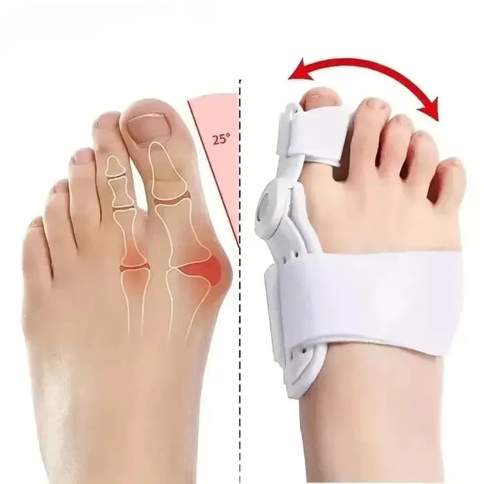 Orthèse pour Hallux Valgus (Oignon) – Modèle Jour et Nuit – Chaussures pour Hommes et Femmes avec Doigts Superposés – Outil d'Orthèse pour l'Éversion du Grand Orteil