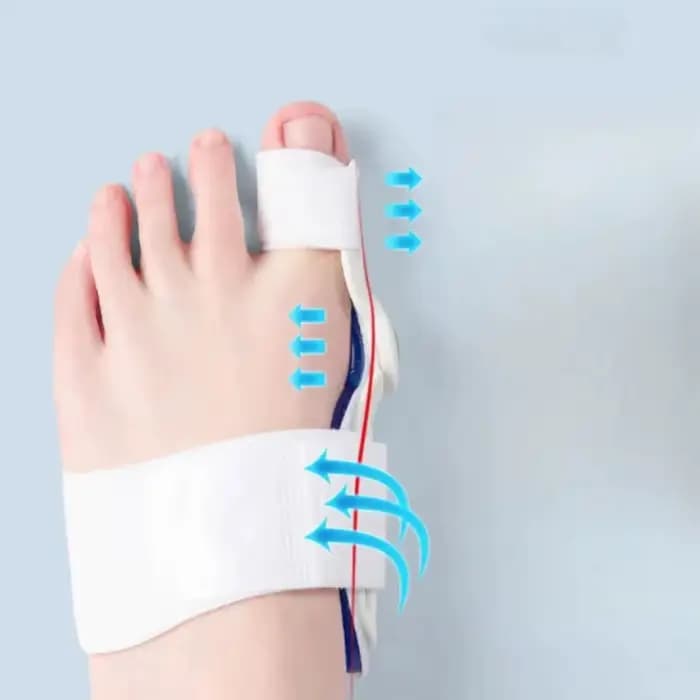 Orthèse pour Hallux Valgus (Oignon) – Modèle Jour et Nuit – Chaussures pour Hommes et Femmes avec Doigts Superposés – Outil d'Orthèse pour l'Éversion du Grand Orteil