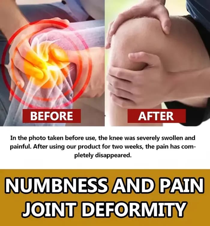 Soutien supérieur pour l'arthrite – Marchez naturellement